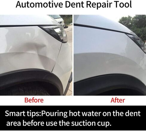 Whisper Whistle 3 Pack Dent Puller, Car Dent Puller, Dent Removal Kit, Powerful Car Dent Remover Tool for Car Dent Repair, Screen, Suction Glass,Tiles, Mirror Lifting and Heavy Objects Moving in Saudi Arabia