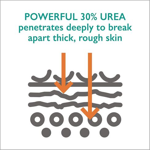 عصا تخفيف مسامير القدم مع يوريا قوية بنسبة 30% - عصا سريعة وسهلة بدون فوضى تساعد على تنعيم وتنعيم الجلد الصلب السميك الجاف والمتشقق والحكة على القدمين والساقين والركبتين والمرفقين in Kuwait