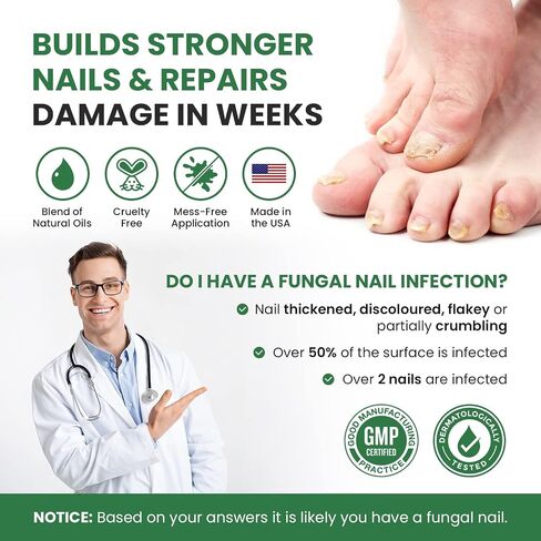 Toenail Renewal Solution Extra Strength Care for Toe Nail & Fingernails - Nail Repair Solution for Thick, broken, Discolored Nails - Renews Damaged Cracked Ingrown Toenail - Tea Tree Oil for Healthier and Extra Strength Nails - Made In USA 0.50 Fl Oz - 1  in Kuwait