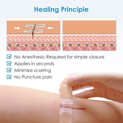 SEABIRD Wound Closure Strips, Emergency Laceration Closures Kits 2Pcs, Hospital Grade Rapid Skin Closure for Home Outdoor, Painless Repair Without Stitch, Bandages for Wound Care & First Aid, Beige in Kuwait