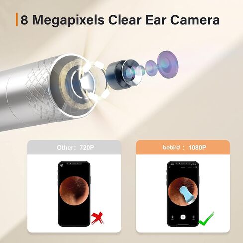 Ear Wax Removal Tool Camera, BEBIRD Ear Cleaning Kit, Earwax Removal Kit with 1080P Otoscope,6LED Light, Ear Wax Removal Kit with 9 Ear Pick, Ear Camera Compatible for iPhone,Android in Saudi Arabia