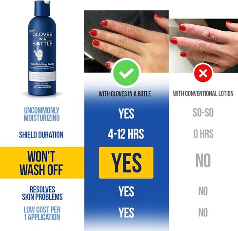 قفازات في غسول واقي للزجاجة، تخفيف الأكزيما والصدفية، 8 أونصة سائلة (عبوة من قطعة واحدة) in Kuwait