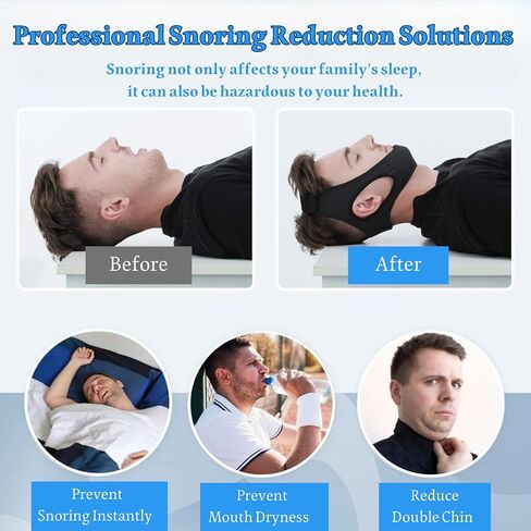 Liphontcta الشخير حزام الذقن حزام الذقن للشخير مريح عالمي حديقة النحت الديكور في الهواء الطلق in Kuwait