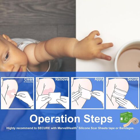 ضمادة مارفيل هيلث هيدروجيل للحروق مقاس 10.16 سم × 10.16 سم، عبوة من 5 وسادات معقمة فردية، استخدام الإسعافات الأولية، بارد، مهدئ، يحمي جميع الحروق، ناعم وقابل للتوافق in Kuwait