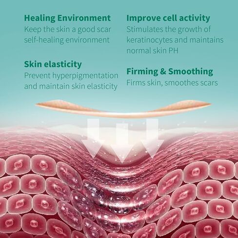 شريط ندبة من السيليكون من Norsumkn مقاس 1.6 × 60 بوصة، ورقة سيليكون قابلة لإعادة الاستخدام لعلاج الندبات وإزالة علامات التمدد وإزالة الوشم وإزالة الندبات غير المؤلمة للجراحة، القسم C، حب الشباب، الجدرة in Kuwait
