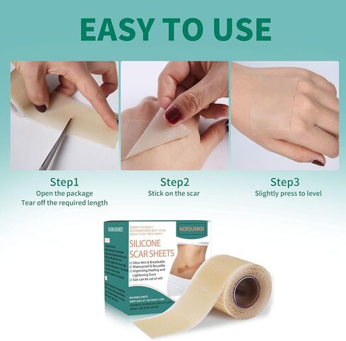 شريط ندبة من السيليكون من Norsumkn مقاس 1.6 × 60 بوصة، ورقة سيليكون قابلة لإعادة الاستخدام لعلاج الندبات وإزالة علامات التمدد وإزالة الوشم وإزالة الندبات غير المؤلمة للجراحة، القسم C، حب الشباب، الجدرة in Kuwait