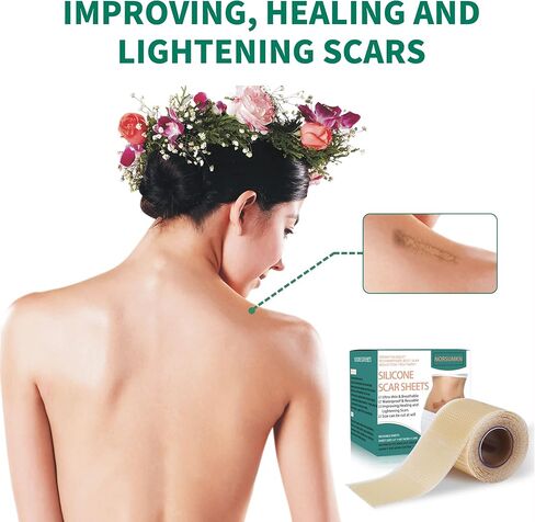 شريط ندبة من السيليكون من Norsumkn مقاس 1.6 × 60 بوصة، ورقة سيليكون قابلة لإعادة الاستخدام لعلاج الندبات وإزالة علامات التمدد وإزالة الوشم وإزالة الندبات غير المؤلمة للجراحة، القسم C، حب الشباب، الجدرة in Kuwait
