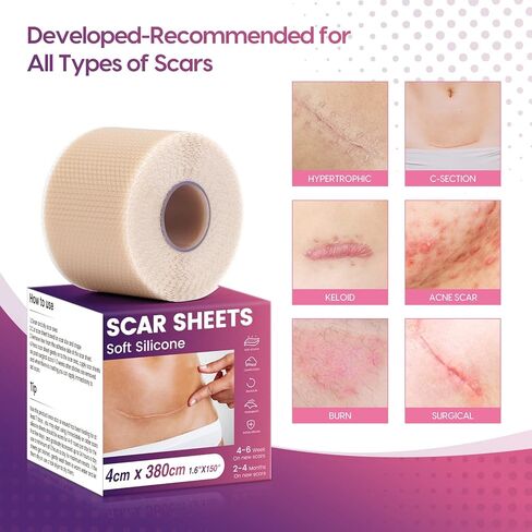 Silicone Scar Sheets (1.6" x 150" Roll-3.8M), Morfone Silicone Scar Tape, Professional and Effective Silicone Scar Removal Strips for C-Section, Surgery, Burn, Keloid, Acne, Upgrade Waterproof in Kuwait