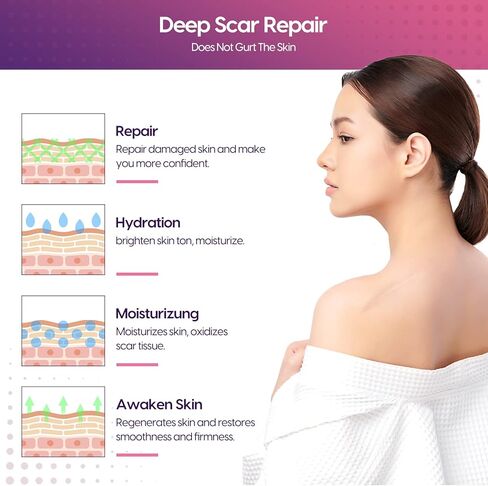 Silicone Scar Sheets (1.6" x 150" Roll-3.8M), Morfone Silicone Scar Tape, Professional and Effective Silicone Scar Removal Strips for C-Section, Surgery, Burn, Keloid, Acne, Upgrade Waterproof in Kuwait