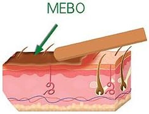 Original Mebo Burn Fast Pain Relief Healing Cream Leaves No Marks 30 Grams in Saudi Arabia