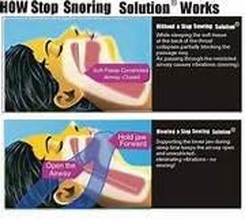 حزام المنصوب للذقن المضاد للشخير، جهاز مساعد على النوم قابل للتعديل للرجال والنساء والأطفال، سدادة الشخير، أجهزة مساعدة على النوم، إيقاف الشخير، عدم الشخير، مساعدات النوم، in Kuwait