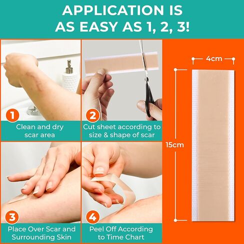 Medical Grade Silicone Scar Sheets – Silicone Gel Sheets for Scars - Self Adhesive, Thin, Breathable Silicone Scar Tape for Stretch Marks, Hypertrophic & Keloid Scar Removal, Pack of 5 (5.91" x 1.57") in Saudi Arabia
