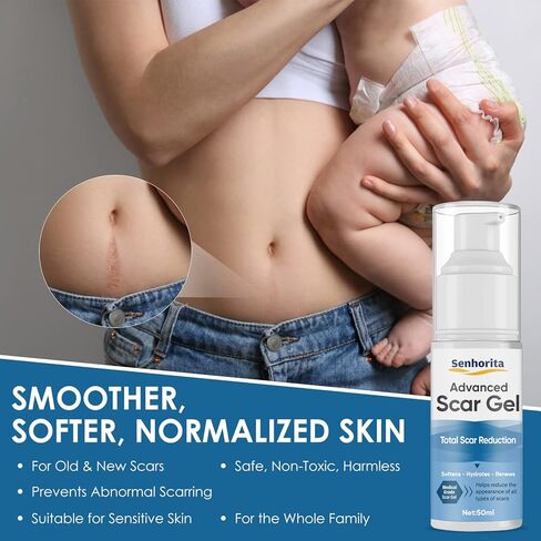 جل كريم الندبات، علاج متقدم للندبات للوجه والجسم، علاجات إزالة الندبات للندبات الجراحية، القسم C، علامات التمدد، حب الشباب، الجدرة، الحروق، الندبات القديمة والجديدة in Kuwait