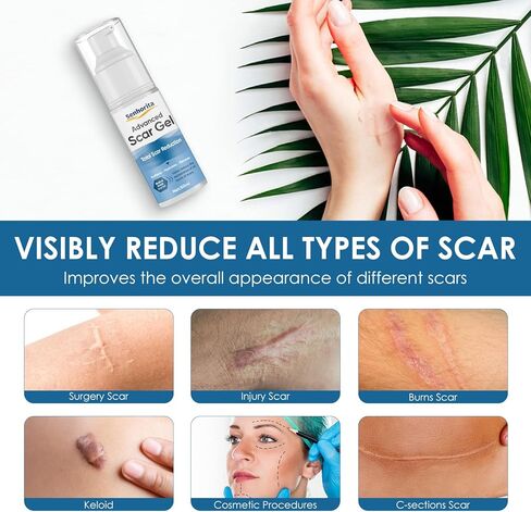 جل كريم الندبات، علاج متقدم للندبات للوجه والجسم، علاجات إزالة الندبات للندبات الجراحية، القسم C، علامات التمدد، حب الشباب، الجدرة، الحروق، الندبات القديمة والجديدة in Kuwait