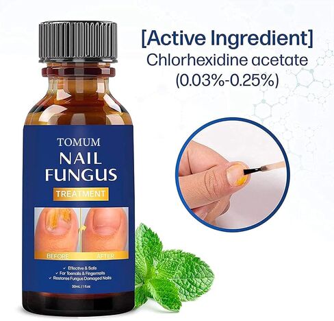Nail Fungus Treatment for Toenail, Extra Strength Effective Fingernail and Toenail Fungus Killer,Nail Repair Solution, Restoring Healthy Nails in Kuwait
