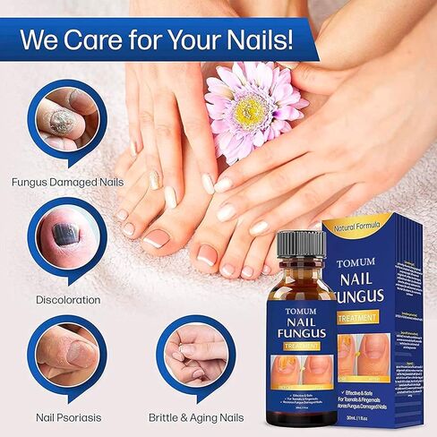 Nail Fungus Treatment for Toenail, Extra Strength Effective Fingernail and Toenail Fungus Killer,Nail Repair Solution, Restoring Healthy Nails in Kuwait