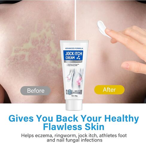 iTecFreely Jock Itch Cream, Powerful & Fast Jock Itch Cream, Jock Itch Treatment Extra Strength for Men & Women, Tinea Corporis, Itch Cream- 60g in Kuwait