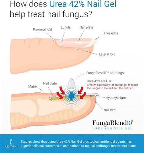 FungaBlend 10 - Urea 42% Nail Gel to Cure Fungus Faster - Delivers Antifungal Medication Directly to Fungus - Quick Results Topical Solution for Toe and Finger Nail Repair Treatment in Saudi Arabia