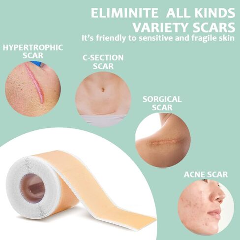 أوراق الندبات المصنوعة من السيليكون - شريط الندبات السيليكون القابل لإعادة الاستخدام، شريط الندبات الجراحية، الحروق، العمليات القيصرية، الجدرة، الصدمات وحب الشباب - إزالة الندبات بدون ألم - علاج احترافي للندبات in Kuwait
