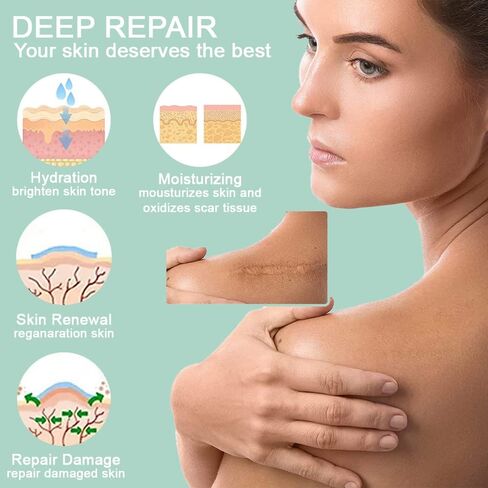 أوراق الندبات المصنوعة من السيليكون - شريط الندبات السيليكون القابل لإعادة الاستخدام، شريط الندبات الجراحية، الحروق، العمليات القيصرية، الجدرة، الصدمات وحب الشباب - إزالة الندبات بدون ألم - علاج احترافي للندبات in Kuwait