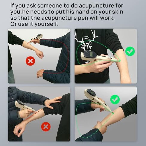 قلم تدليك إلكتروني لوخز بالإبر من بيتر آنجل، قلم تدليك إلكتروني للوخز بالإبر قلم قلم رفع لتخفيف الألم عند الظهر، قلم كهربائي للعلاج بالوخز بالإبر بالكهرباء in Kuwait