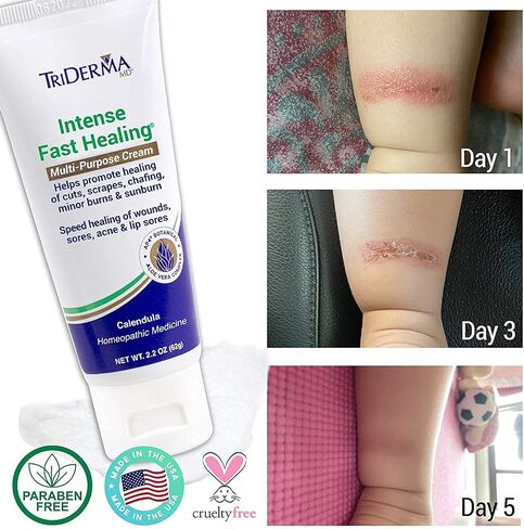 TriDerma Intense Fast Healing Multi-Purpose Cream for Cuts, Scrapes, Sores, Chafing, Minor Burns and Sunburn (2.2 oz Tube) in Saudi Arabia