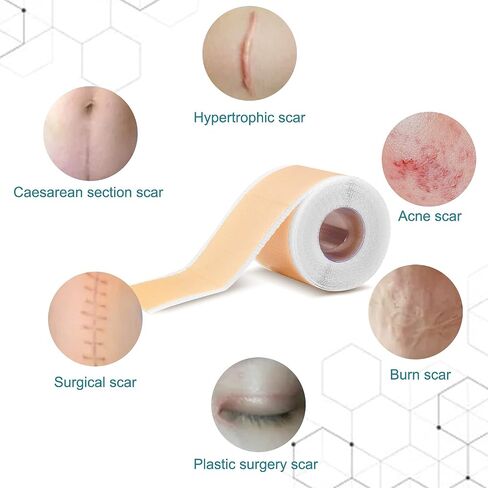 KUREWO Silicone Scar Tape Scar Sheet - Upgrade Professional Medical Scar Removal Treatment, Non irritating, Reusable, Painless for C-Section, Surgical Scars, Burn, Keloid, Acne et in Saudi Arabia