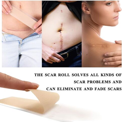 KUREWO Silicone Scar Tape Scar Sheet - Upgrade Professional Medical Scar Removal Treatment, Non irritating, Reusable, Painless for C-Section, Surgical Scars, Burn, Keloid, Acne et in Saudi Arabia