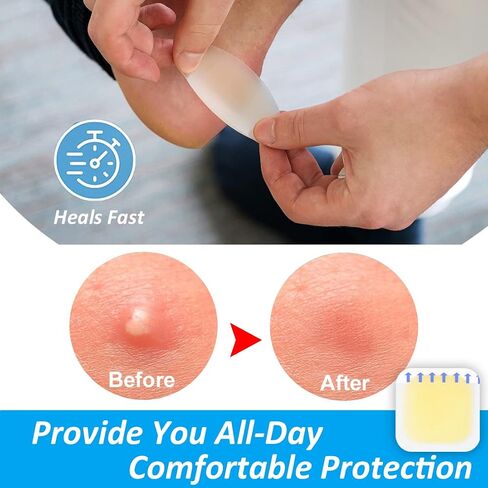 Blister Bandages, Blister Pads (15PCS) Gel Blister Cushions, Blister Pads, Hydrocolloid Seal Adhesive Bandages for Fingers, Toes, Heel Blister Prevention & Recovery (Square-15pcs) in Kuwait