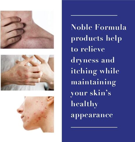 Noble Formula, Alise's Maintenance Cream, Steroid Free with 5% Ammonium Lactate, 0.125% Pyrithione Zinc (ZnP), Moisturizing Cream, 4 oz in Saudi Arabia