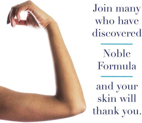 Noble Formula, Alise's Maintenance Cream, Steroid Free with 5% Ammonium Lactate, 0.125% Pyrithione Zinc (ZnP), Moisturizing Cream, 4 oz in Saudi Arabia