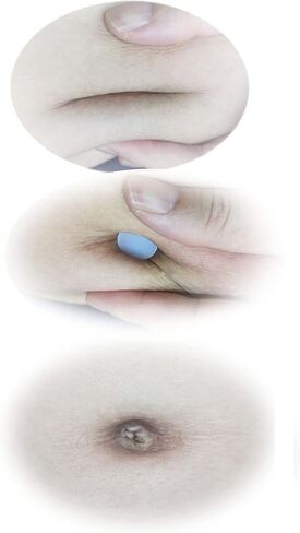 15 قطعة (6 قطع احجام مختلفة) من جليدليو من السيليكون اللين لشد البطن لشفط الدهون او اصلاح الفتق السري، 6 قطع (عبوة من 1)، (cdg005) in Kuwait