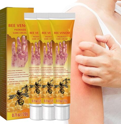 3 قطع من كريم العناية بالصدفية بسم النحل من AQISI، كريم العناية بالصدفية الاحترافي لسم النحل النيوزيلندي، كريم الصدفية المهدئ والمرطب in Kuwait