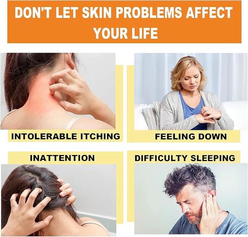 3 قطع من كريم العناية بالصدفية بسم النحل من AQISI، كريم العناية بالصدفية الاحترافي لسم النحل النيوزيلندي، كريم الصدفية المهدئ والمرطب in Kuwait