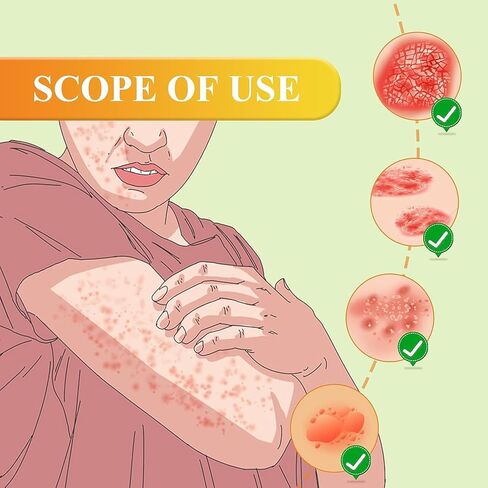 3 قطع من كريم العناية بالصدفية بسم النحل من AQISI، كريم العناية بالصدفية الاحترافي لسم النحل النيوزيلندي، كريم الصدفية المهدئ والمرطب in Kuwait