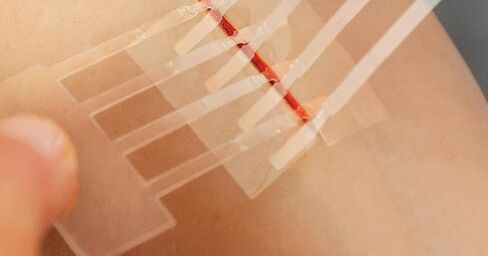 Clozex Emergency Laceration Kit - Repair Wounds Without Stitches, Skin Closure Device for a Wound Up to 1 1/2 Inches Length. Complete Kit to Clean, Close, & Cover Wounds in Kuwait