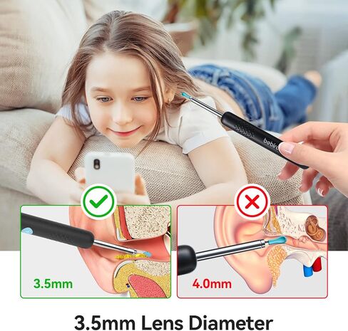 إزالة شمع الأذن - أداة إزالة شمع الأذن R1 مع كاميرا عالية الدقة 1080 بكسل و6 مصابيح LED - منظف الأذن اللاسلكي المدمج واي فاي - مجموعة إزالة شمع الأذن المتوافقة مع iPhone Android in Kuwait