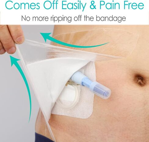 غطاء دش مقاوم للماء للجروح، ضمادة لاصقة مع وسادة مركزية غير لاصقة لجراحة البطن، قطع الجروح، حامي الصدر، منفذ العلاج الكيميائي للرجال والنساء، 6 × 6 بوصة (عبوة من 25) in Kuwait