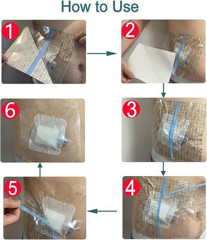 غطاء دش مقاوم للماء للجروح، ضمادة لاصقة مع وسادة مركزية غير لاصقة لجراحة البطن، قطع الجروح، حامي الصدر، منفذ العلاج الكيميائي للرجال والنساء، 6 × 6 بوصة (عبوة من 25) in Kuwait