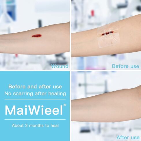إصلاح التمزقات بالغرزة المضغوطة بدون غرز، ضمادات الفراشة، الجلطة السريعة - جهاز إغلاق الجروح في حالات الطوارئ قطعتين (قماش غير منسوج) in Kuwait