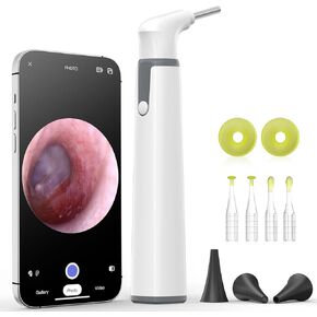 كاميرا أذن Anykit اللاسلكية مع رؤية مزدوجة، نطاق أذن WiFi 3.9 مم 720PHD مع أداة إزالة شمع الأذن للأطفال والكبار والحيوانات الأليفة، متوافقة مع Android وiPhone in Kuwait