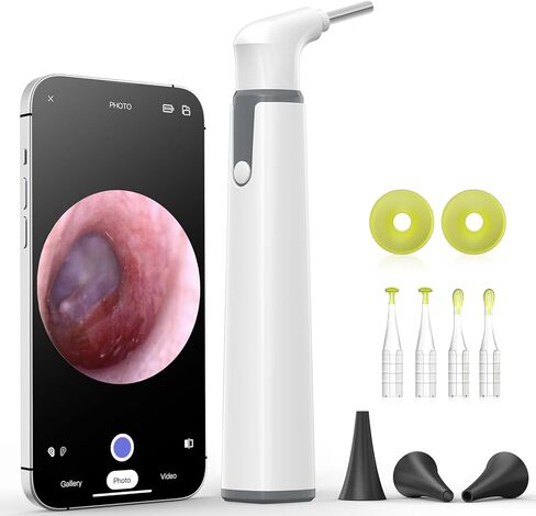 كاميرا أذن Anykit اللاسلكية مع رؤية مزدوجة، نطاق أذن WiFi 3.9 مم 720PHD مع أداة إزالة شمع الأذن للأطفال والكبار والحيوانات الأليفة، متوافقة مع Android وiPhone in Kuwait