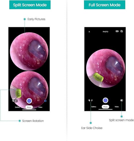 كاميرا أذن Anykit اللاسلكية مع رؤية مزدوجة، نطاق أذن WiFi 3.9 مم 720PHD مع أداة إزالة شمع الأذن للأطفال والكبار والحيوانات الأليفة، متوافقة مع Android وiPhone in Kuwait