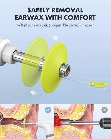 كاميرا أذن Anykit اللاسلكية مع رؤية مزدوجة، نطاق أذن WiFi 3.9 مم 720PHD مع أداة إزالة شمع الأذن للأطفال والكبار والحيوانات الأليفة، متوافقة مع Android وiPhone in Kuwait