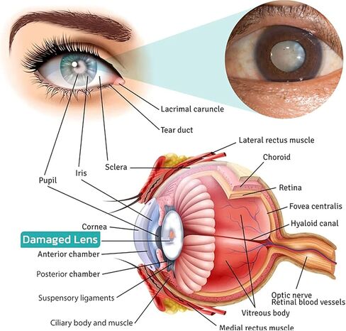 OphthlaMed Vision Enhance Roller, Vision Enhance Massage Roller, Relieve Eye Fatigue Enhance Eye Clarity for Dry Eyes, unclear and Blurred Eyes（2PCS） in Kuwait