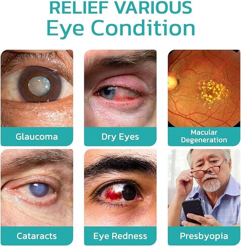 OphthlaMed Vision Enhance Roller, Vision Enhance Massage Roller, Relieve Eye Fatigue Enhance Eye Clarity for Dry Eyes, unclear and Blurred Eyes（2PCS） in Kuwait