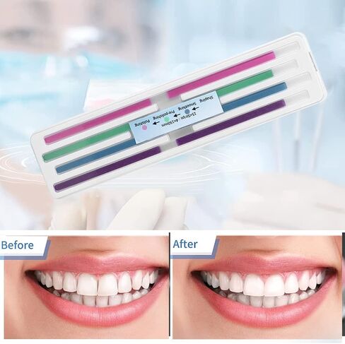 شرائط التشطيب المتداخلة للأسنان، شرائط تلميع الأسنان، 60 قطعة/الحزمة شرائط كاشطة للأسنان، مجموعة أدوات تحديد لمعان الأسنان in Kuwait