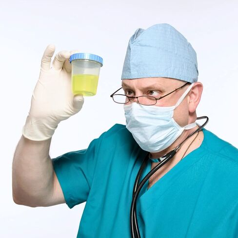 Specimen Cups with Leak Proof Screw on Lids - 4oz [Pack of 25] Clear Non-Sterile Urine Sample Jars - Containers for Safe Pee, Stool, Semen Sample Collection for Testing (25) in Saudi Arabia