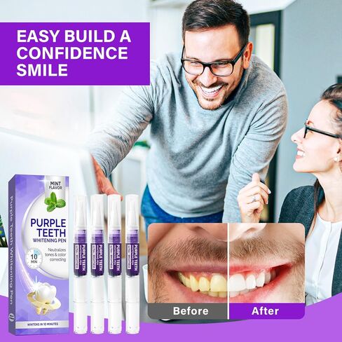 معجون أسنان أرجواني لتبييض الأسنان، مجموعة تبييض الأسنان، معجون أسنان أرجواني لتبييض الأسنان، تبييض سريع، ابتسامة واثقة، نفس منعش، 4 قطع in Kuwait