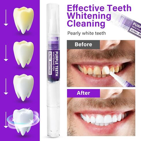 معجون أسنان أرجواني لتبييض الأسنان، مجموعة تبييض الأسنان، معجون أسنان أرجواني لتبييض الأسنان، تبييض سريع، ابتسامة واثقة، نفس منعش، 4 قطع in Kuwait